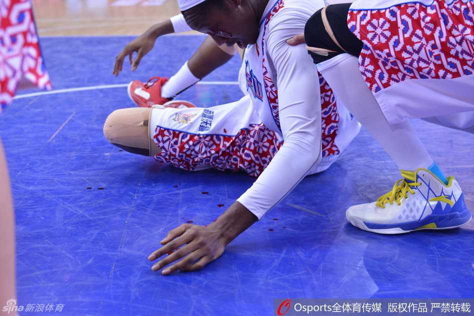 赛后，新疆队医为查尔斯的伤口进行清创和缝合，严重的伤势意味着她很可能缺席接下来的决战，但她已是球迷心中的英雄。