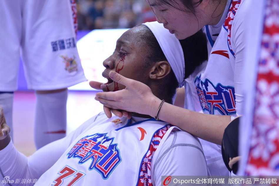 遭到意外肘击的查尔斯痛苦地捂住面部，但鲜血依然止不住地从指缝中渗出，剧烈的疼痛让她瞬间倒地。