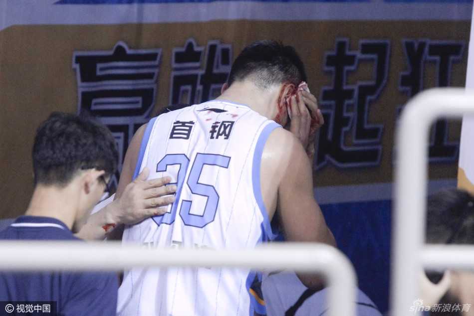 队友们迅速围拢过来，第一时间查看张松涛的伤势，队医紧急冲入赛场