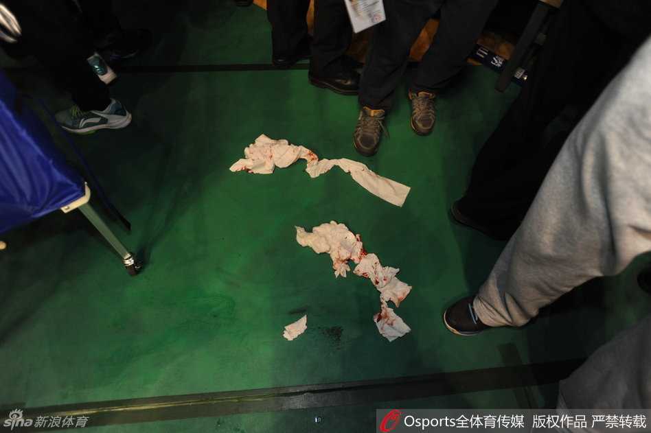 赛场惊魂:郭艾伦遭水瓶袭击血洒本溪,文明底线何在 队友韩德君等人神情关切地围绕在受伤的郭艾伦身边,试图用身体筑起人墙保护他,同时焦急地向场边示意寻求担架帮助。