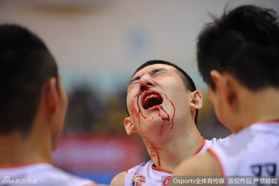 队医正焦急地为躺在地上的付豪进行紧急止血，付豪的整个面部已是血肉模糊，鲜血流淌到下巴和脖颈，他的表情因剧烈疼痛而显得有些扭曲。