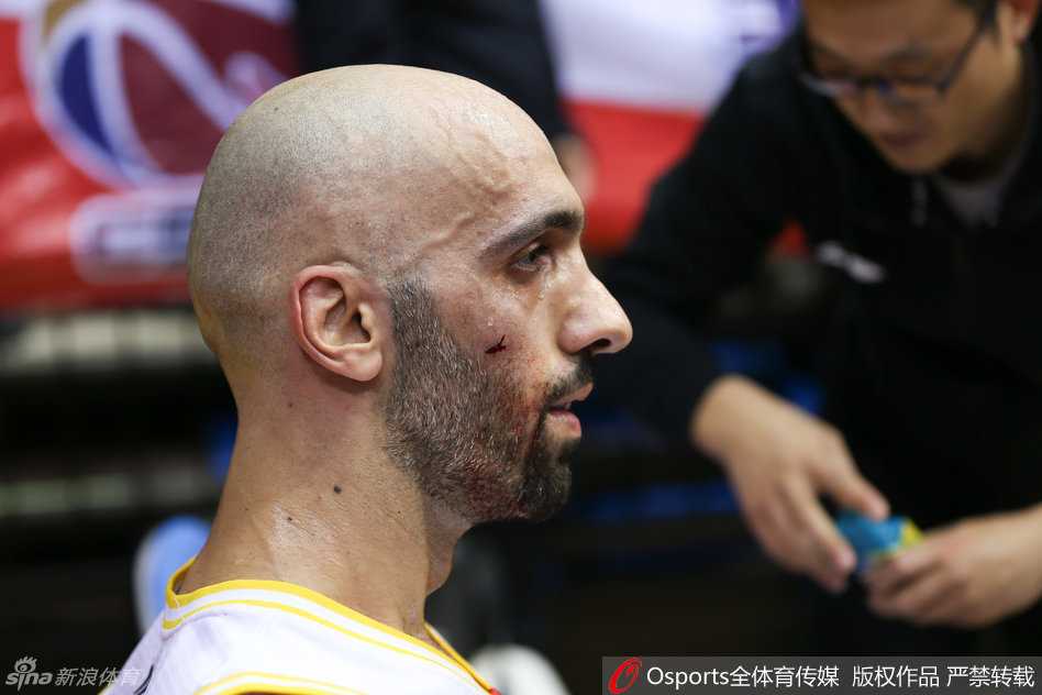 阿巴斯在队友搀扶下起身，指着自己流血的脸部，愤怒地向裁判展示伤情并要求公正判罚。