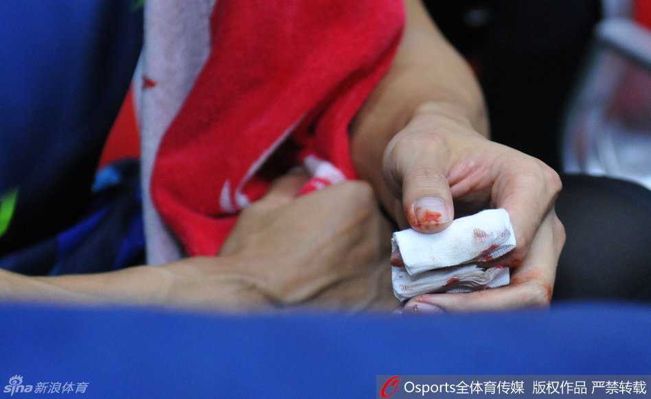 鮮血從指間滲出，易建聯低頭凝視著傷口，眼神裡充滿了對戰局的不甘與無奈。