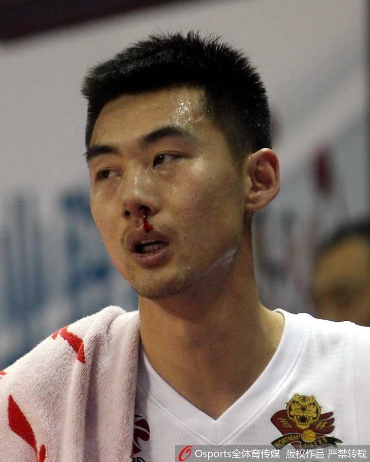 崔晋铭在场边接受紧急治疗，他用手指按压住受伤的鼻梁，眼神却始终望着场内，流露出重返赛场的渴望。